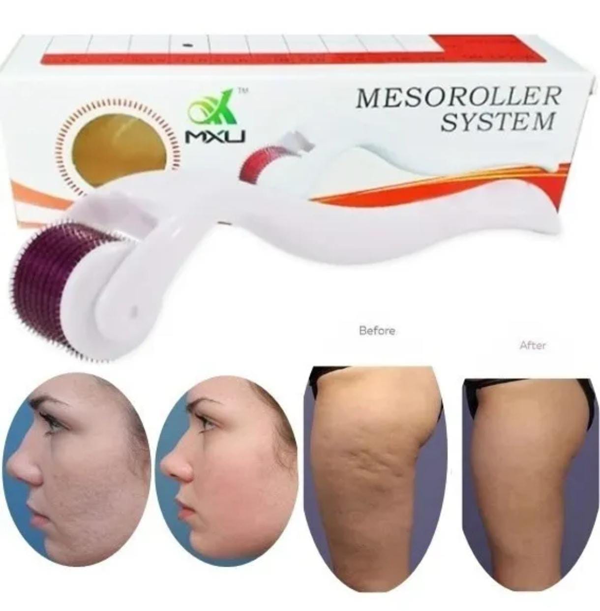 Miniatura 4 de DERMAROLLER FACIAL